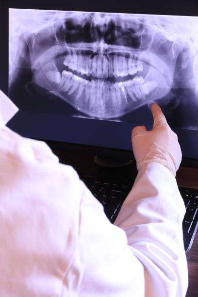 Best Emergency Wisdom Teeth Removal in Bardmoor, FL