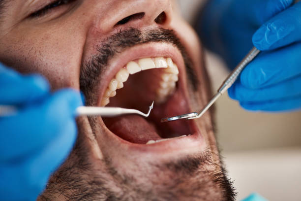 Best Emergency Broken Tooth Repair in Bardmoor, FL